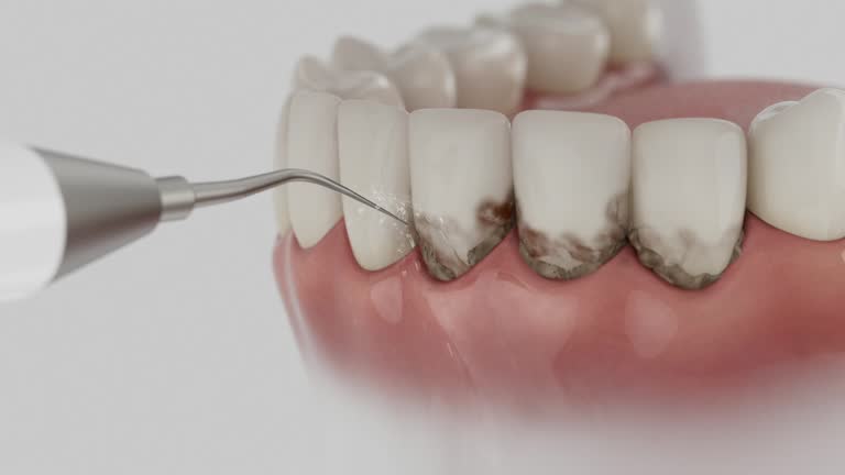 Reliable Emergency Dentist contractor in Iva, SC by Smile Center Dentistry
